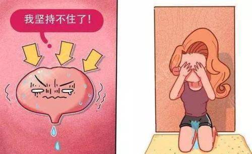 盆底脱垂伴压力性尿失禁，采用“一步法”还是“两步法”？