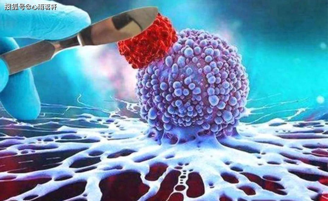 原创            塞来昔布作用：对抗癌细胞增殖，增加化疗敏感性，诱导癌细胞凋亡