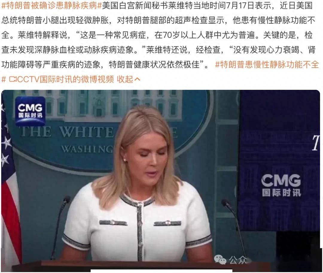 特朗普腿肿，是“静脉功能不全”？这病其实很多人都有！