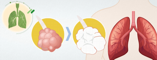 不是癌症，但确诊后只能活2-3年？有类似症状需及时就医！