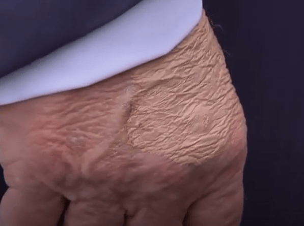 美媒：特朗普再次被拍到手背涂抹遮瑕膏，白宫解释