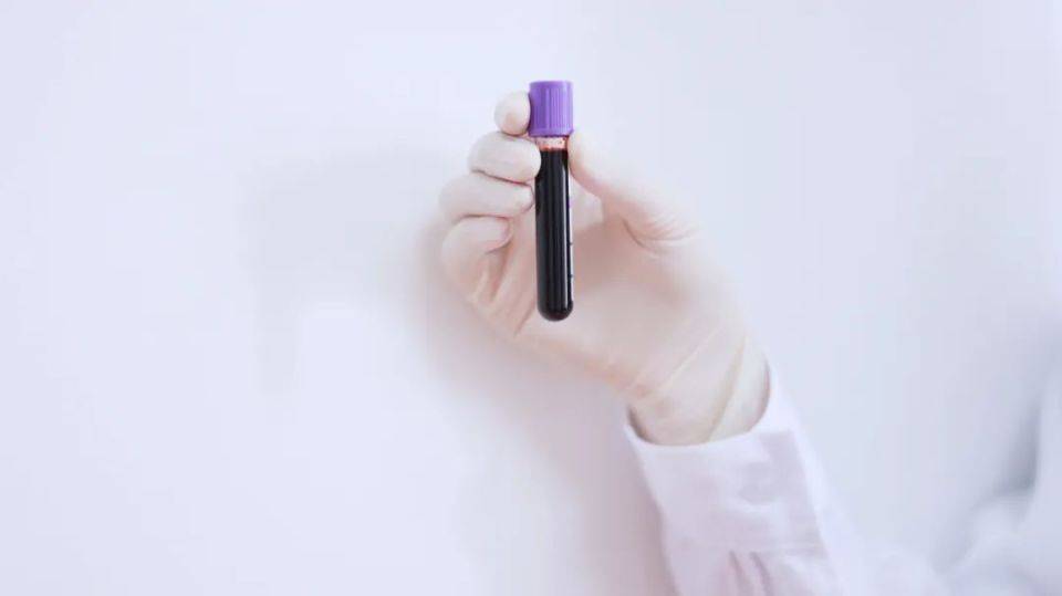 体检时这4个项目可以不做，不妨转告家人，以免花冤枉钱