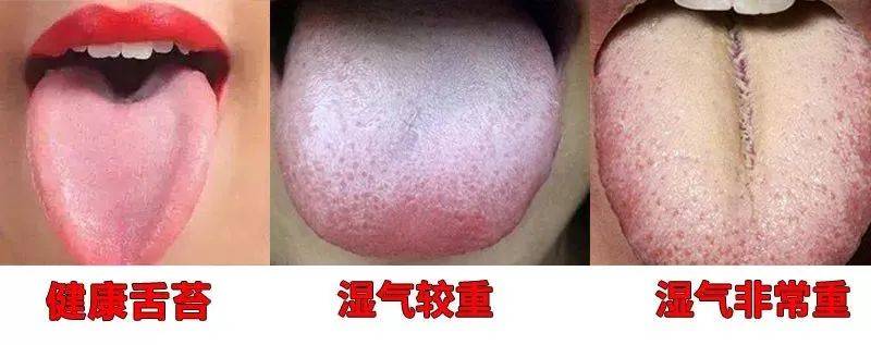 屁股上有个“祛湿总开关”，打开它，逼出20年的湿毒