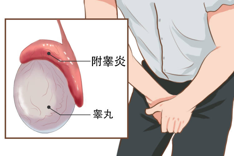 慢性附睾炎很难治愈吗？认清这几点是关键