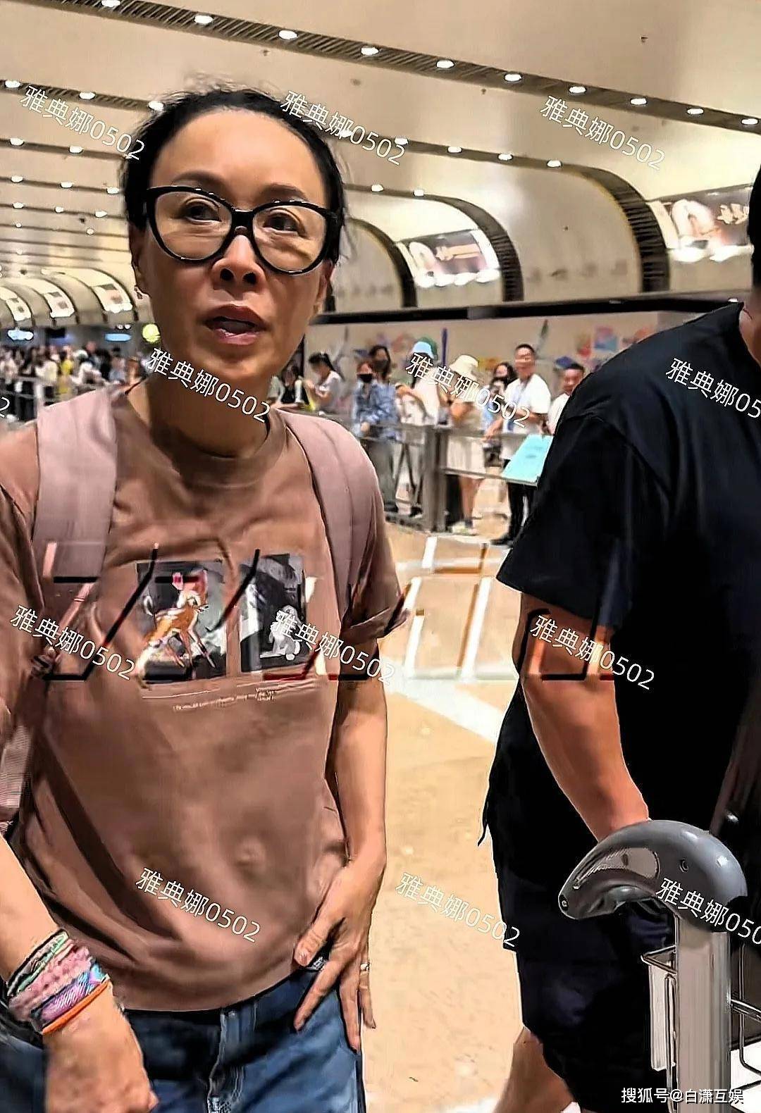 原创            那英机场被偶遇：她的额头是填充还是植发？显得肿胀突起很不自然