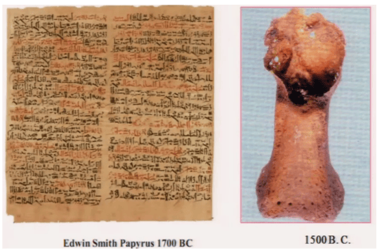 千万人的困扰：解密痛风，破解“尿酸魔咒”