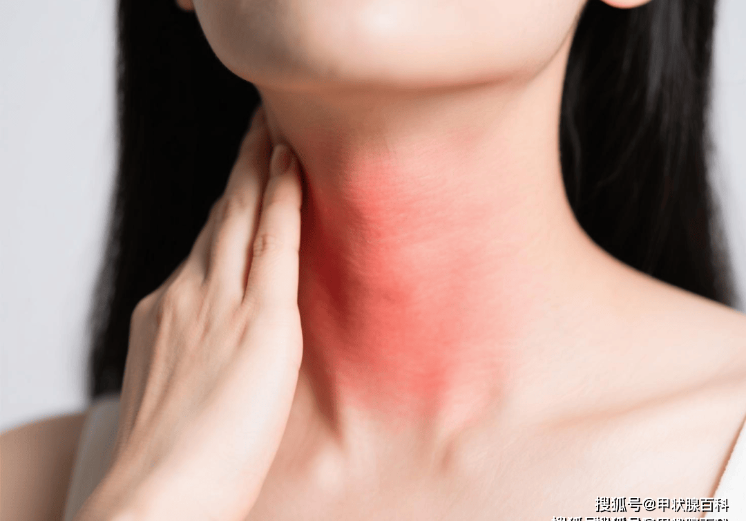 南昌第五医院甲状腺科江辉主任：甲状腺不好，往往会有5个症状！