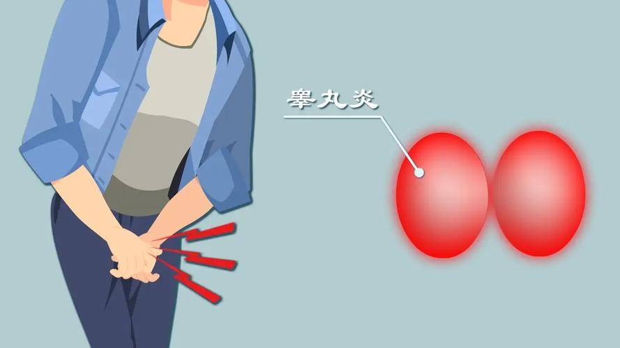 睾丸炎严重程度自测：出现这3个症状需就医