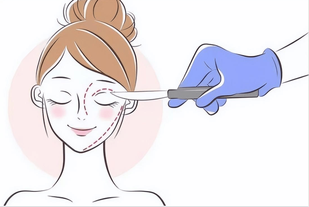 医疗美容受欺诈可主张惩罚性赔偿