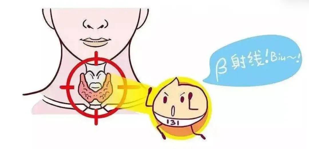 用碘131治疗甲亢后,需要注意些什么?