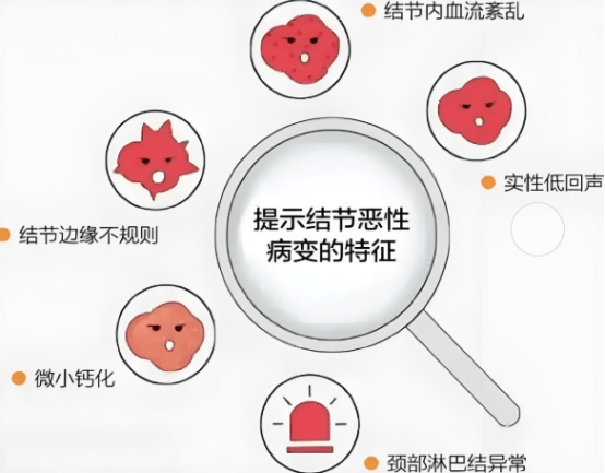 甲状腺结节有这7个特征，癌变风险高！武春青教授总结诊治要点，一文讲清