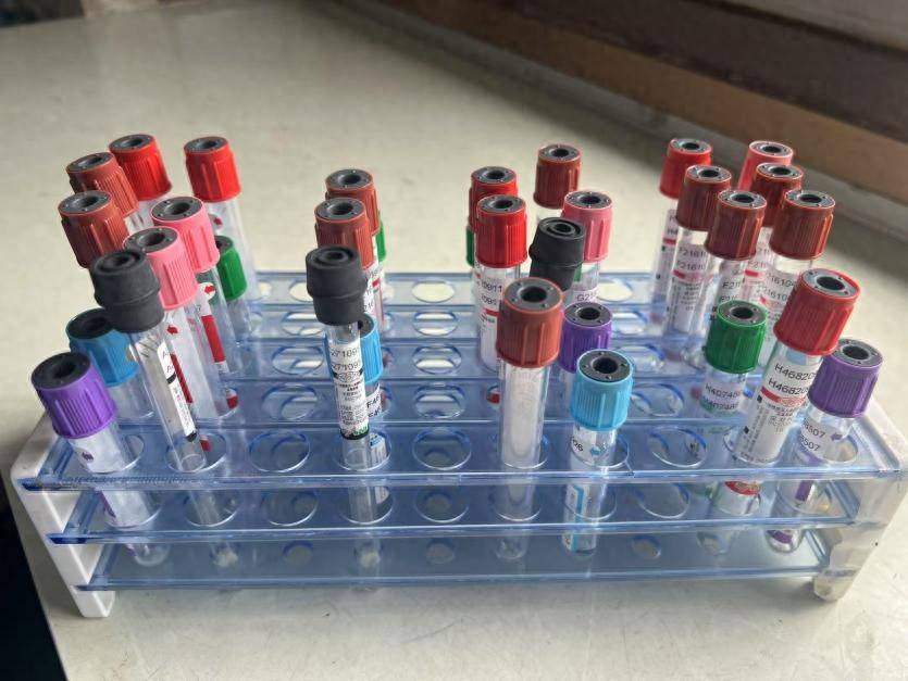 小小试管架，让护理更高效、更安心