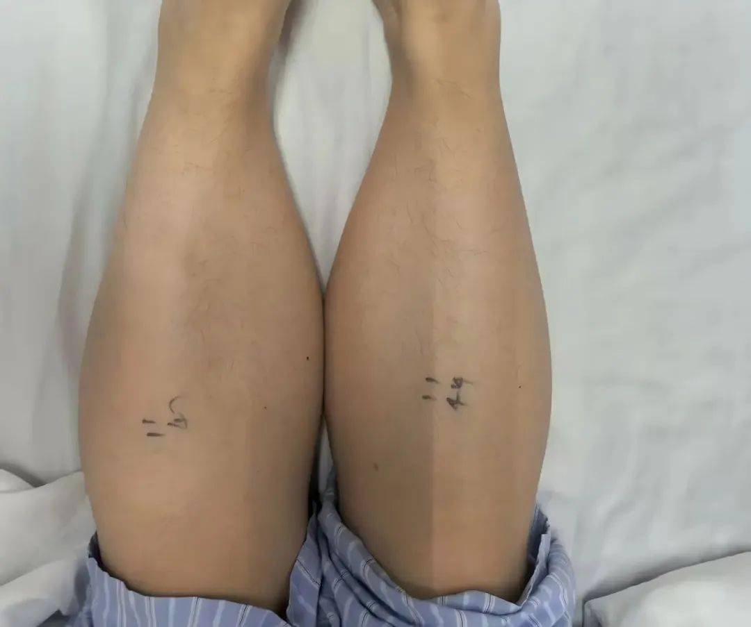 近期接诊200多例！肿胀疼痛、皮肤发热变色……