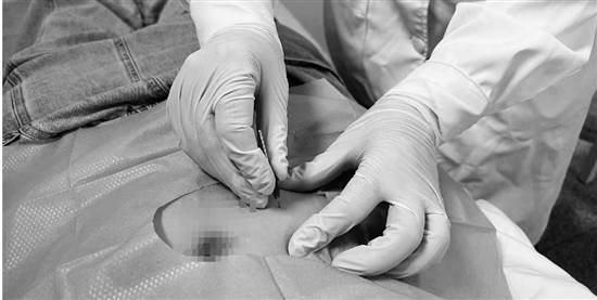 一人减肥，八面来风 四路专家，多管齐下