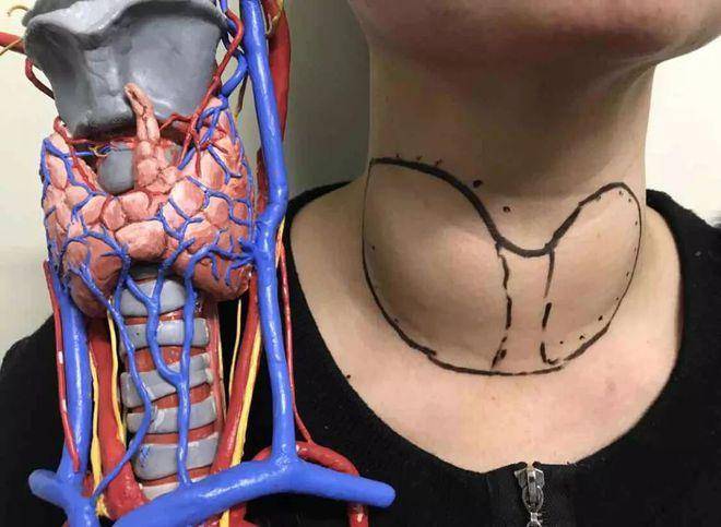 胆固醇偏高？别忘了查查甲状腺这个“代谢总开关”