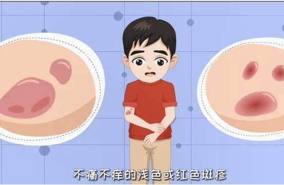 红斑、白斑不痛不痒，眉毛脱落.....延误诊治或致残疾！