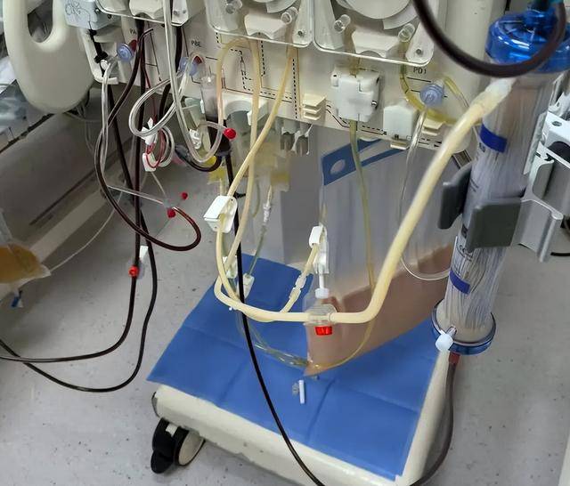 35岁男子得急症血液变奶茶状，医生提醒