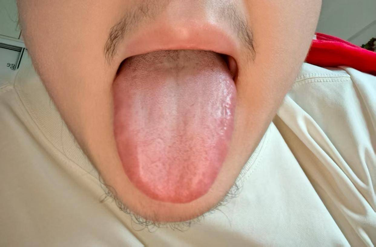 破瘀滞，生新血：6味食材疏通气血之道