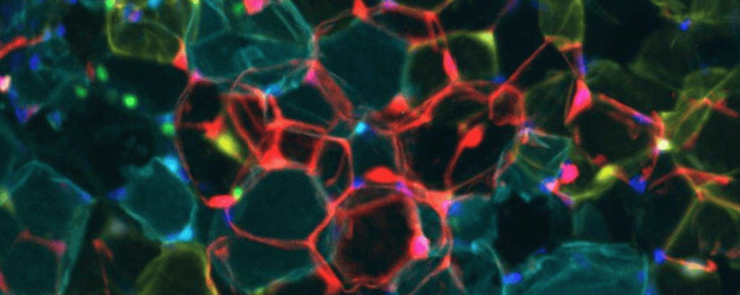 科学家发现“燃脂开关”！这种氨基酸或是减肥关键