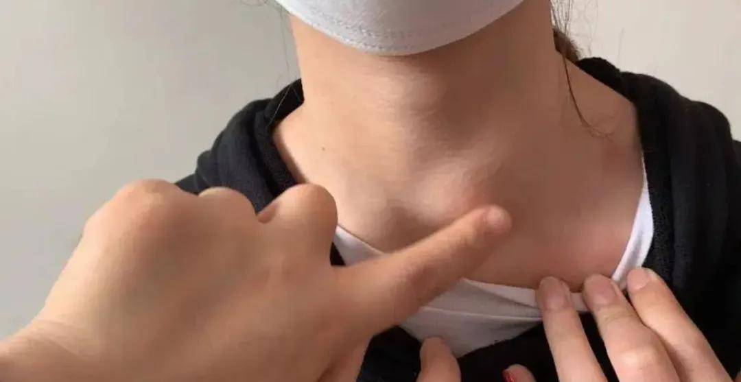 甲状腺切除后 3 个问题找上门！