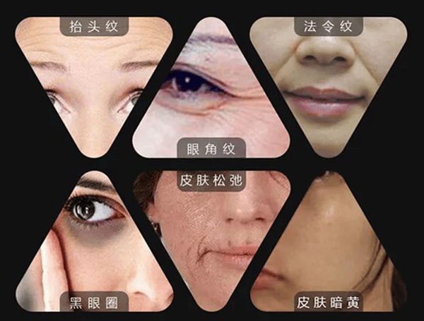 抗衰必看：热玛吉的功效与作用、热玛吉的真实效果