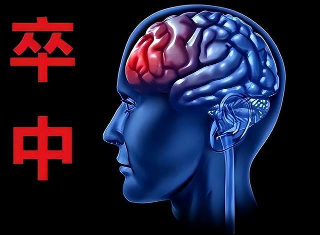 原创            卒中开始年轻化，30秒快速识别，关键时刻能救命！