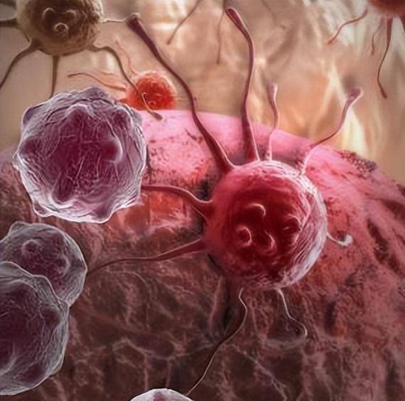 原创            癌症再也不怕了？七旬肺癌老人绝处逢生，负170度冻死癌细胞获救