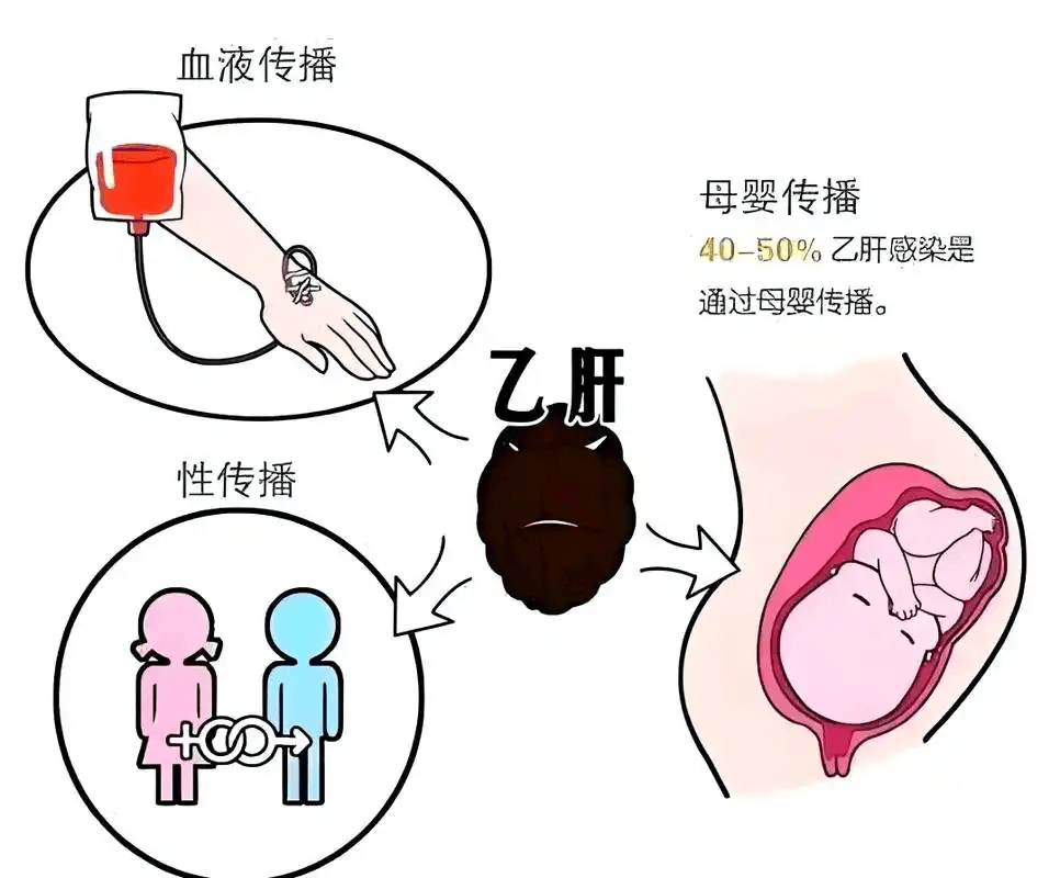 在外就餐，真的容易感染乙肝吗？