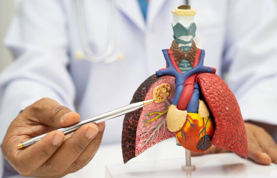 原创            没有咳嗽却确诊肺癌！医生警告：这5个身体信号再忽视就晚了