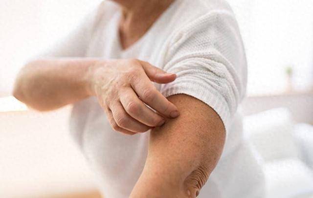 医生调查200名带状疱疹患者，意外发现：患病的人，有3个共同点