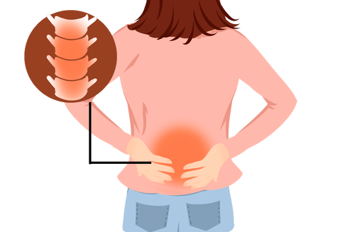 追根溯源：腰间盘突出的成因探究