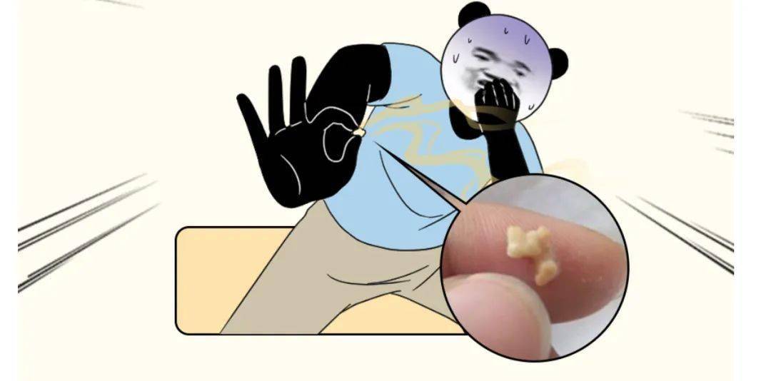 牙缝里抠出的臭臭，到底是啥？