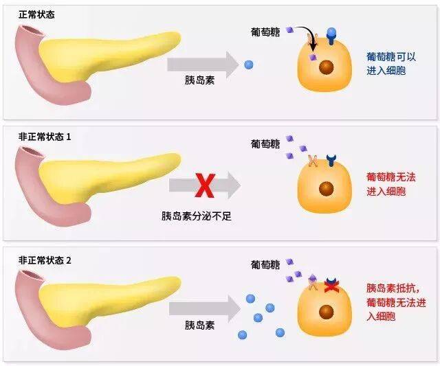 一个阻止你变瘦的原因，很多人都不知道