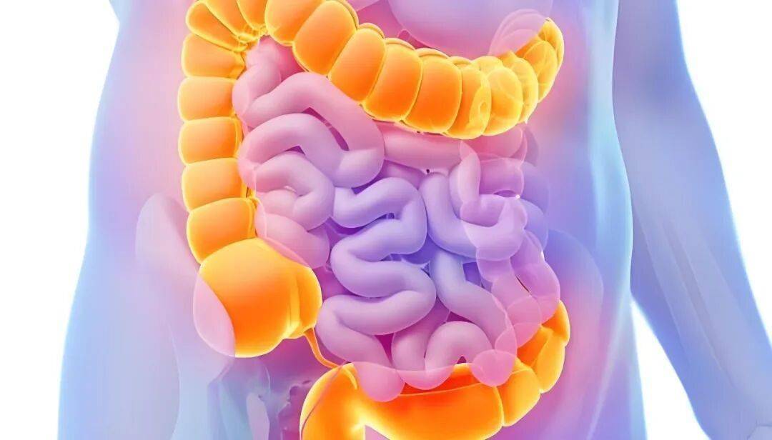 新见解！南京大学/上海交大/南京中医药大学联合发文：可降低肠癌风险的炎症调控靶点