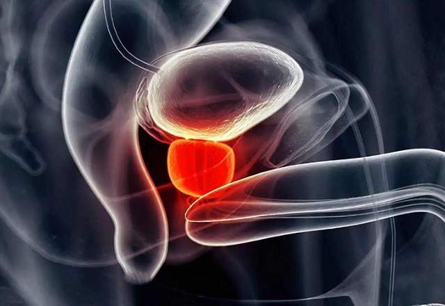 原创            前列腺炎正影响超一半的成年男性，出现这些症状，别当上火了！