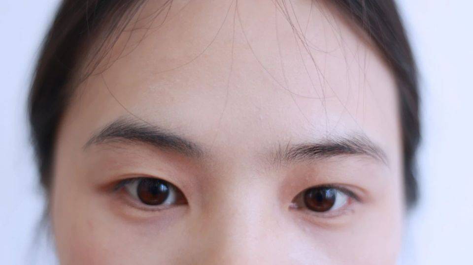 原创            眼睛出现这2种变化，多半是癌上身，别以为只是单纯地用眼过度