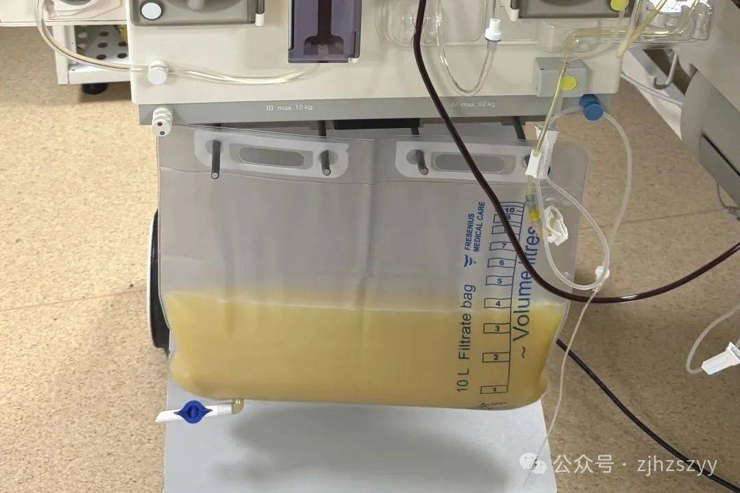 血液变“牛奶”！浙江40岁老总一场酒局后躺进ICU！医生：易发展为重症