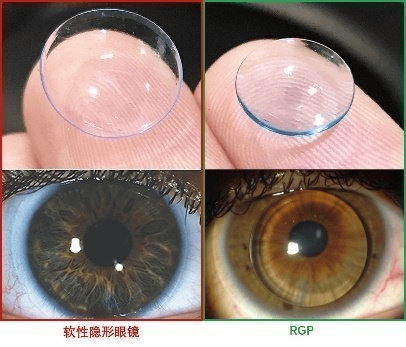 高度近视人群戴框架眼镜，为什么更容易视疲劳？