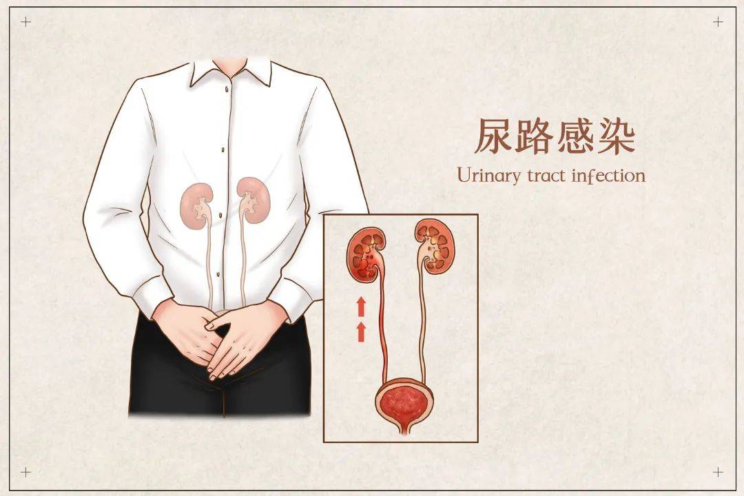 三伏天这种病高发，女性患病风险比男性高8倍