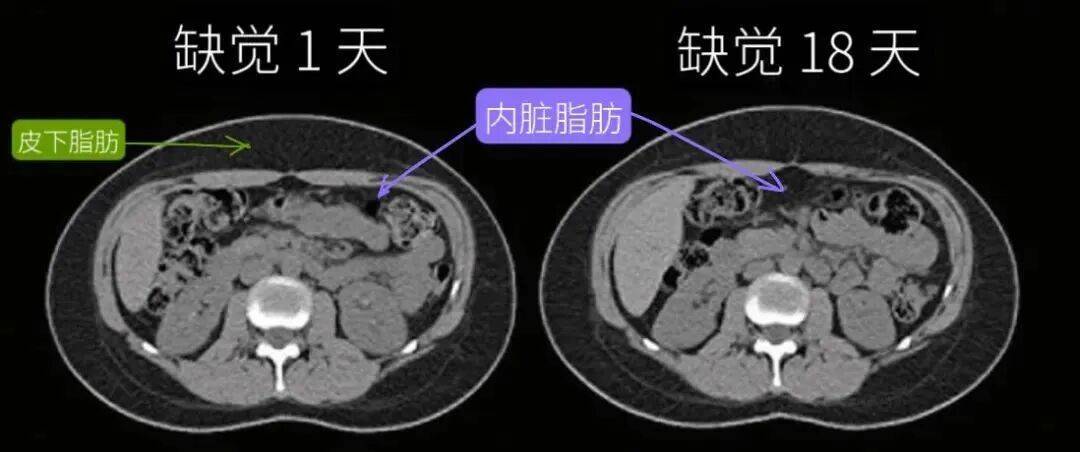 这样睡真的能减肥！看看你适不适合→