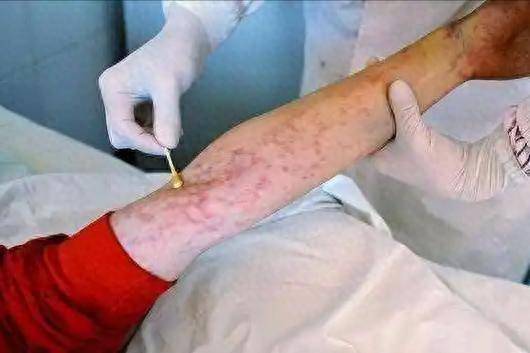 艾滋病新增130万例，医生苦劝：公共场合谨记这4件事，别小瞧！