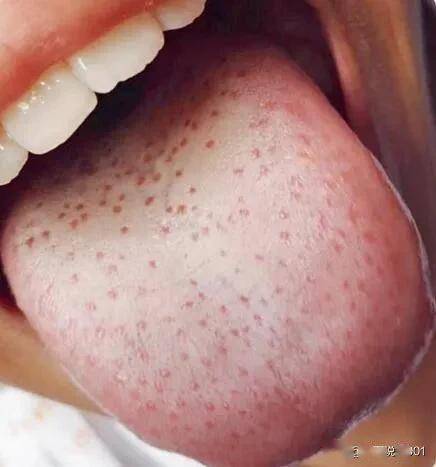 三伏天祛湿，茯苓才是“隐藏高手”：这样吃利水不伤脾，痰湿没了