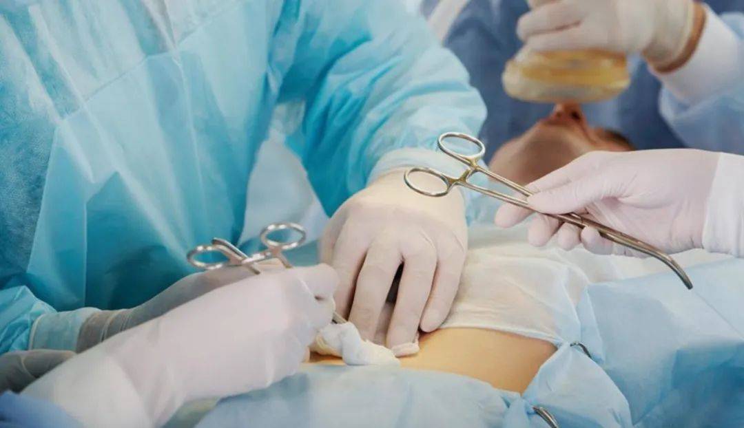 收5000元“飞刀费”被举报，这次卫健委站在了医生这边