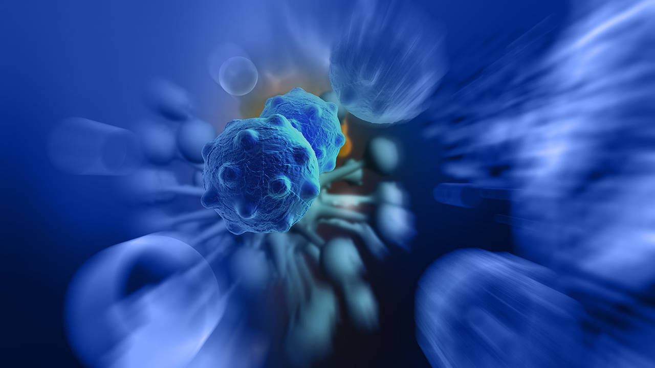 活出质量：腮腺癌患者术后四年的生活智慧