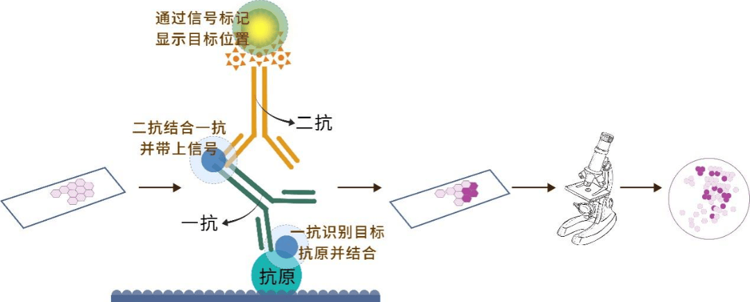 肺癌病理报告中的几个加号“+”竟是治疗密码，一文教你看懂！