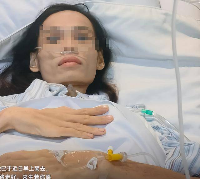 原创            32岁余燕丽去世：生前画面曝光，肚子大的像皮球，死因背后太现实