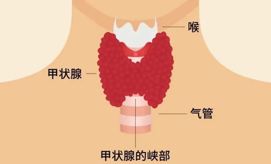 声音嘶哑、吞咽困难别总以为是上火！可能是脖子里的“懒癌”露出了獠牙