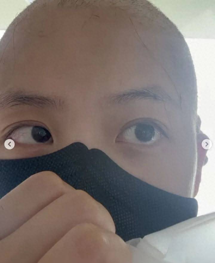 26岁女星消失三个月后，突然晒光头照片：确诊白血病