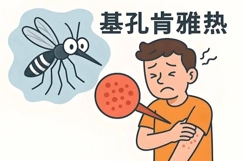 警惕基孔肯雅热！家庭防蚊全攻略在此