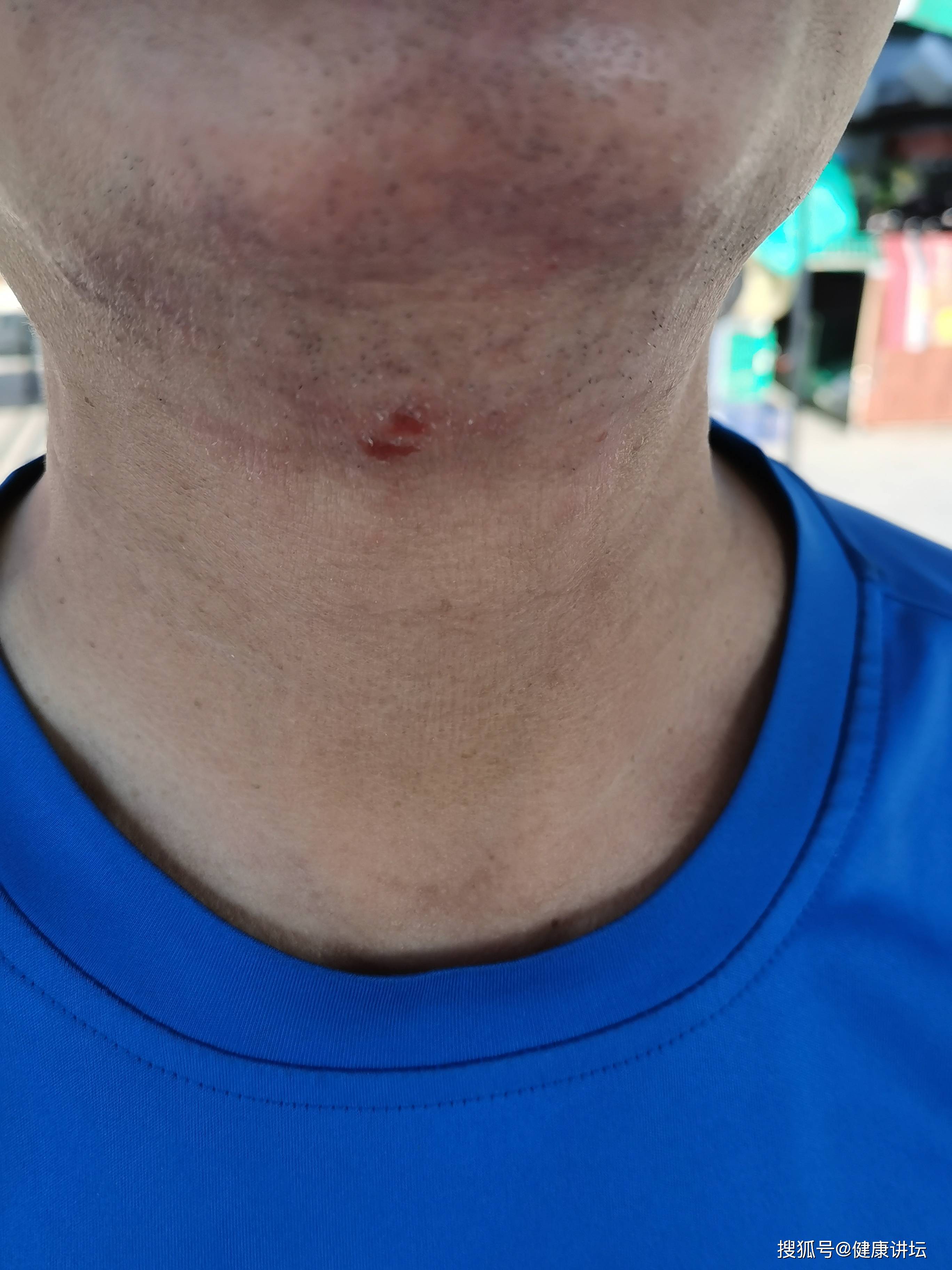 经历最严重的排毒